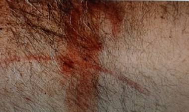 Repudio: Atacan a golpes al normalizador de ATE en Mercedes