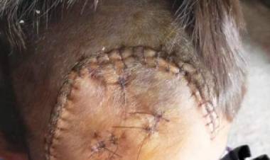 Conmoción y pedido de justicia: MERCEDES investiga brutal agresión a un niño