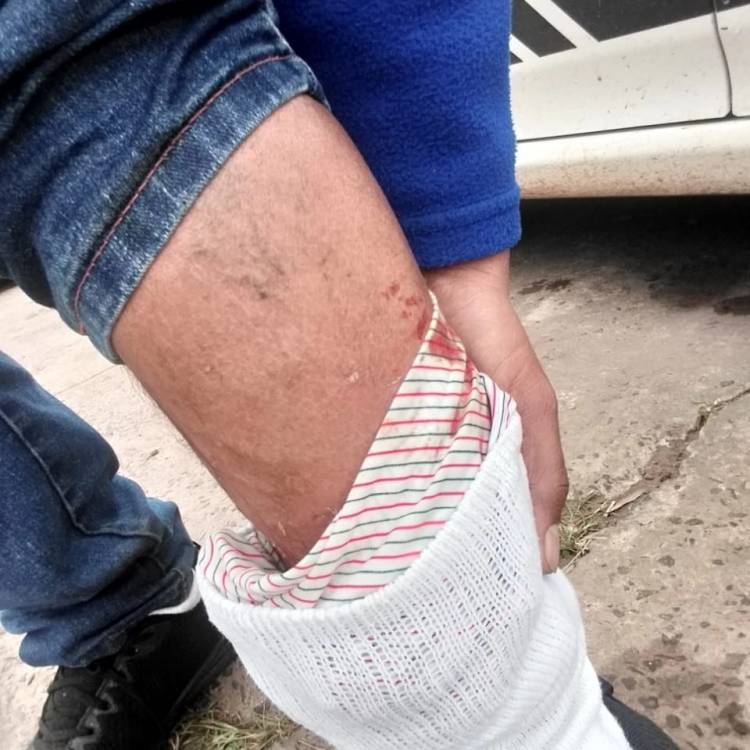 Mercedes : Vecino Sufrió Ataque de Perro en el Barrio José María Gómez