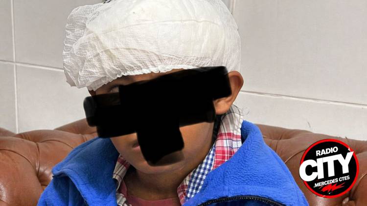 MERCEDES: detuvieron a un sospechoso por la brutal agresión a un chico de 12 años
